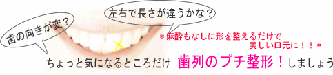 ����̃v�`���`���܂��񂩁H�ɂ��Ȃ��`�𐮂��邾���Ŕ����������ɁI